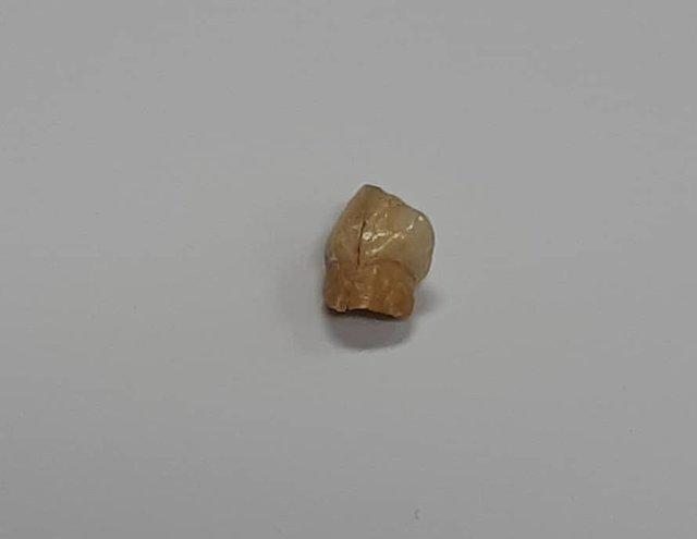 رونمایی از نخستین دندان انسان اولیه ایرانی