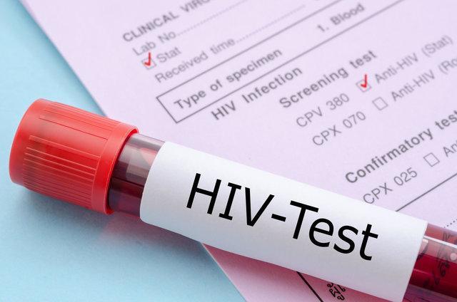 علائم HIV در زنان