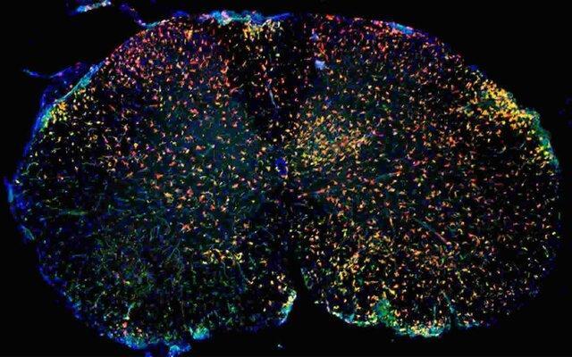 نوع جدیدی از سلول های ایمنی عامل بیماری ام .اس هستند
