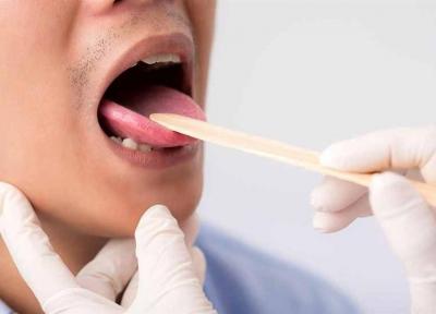 سرطان زبان چه نشانه هایی دارد؟
