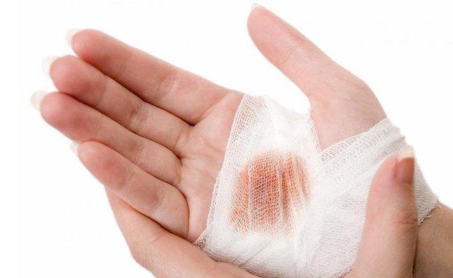 زخم هایی که می تواند سبب مرگ بیمار گردد