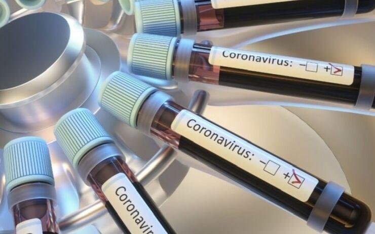 آزمایش واکسن سرخک راه حل جدید فرانسه برای مقابله با کرونا