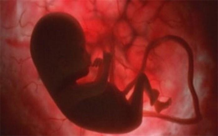 خون بندناف زباله بیولوژیک نیست