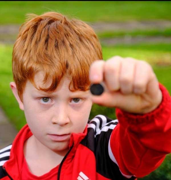 سرنوشت جالب پسربچه پس از قورت دادن یک باتری!