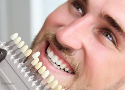 راه های سفیدی دندان؛ برای سفید شدن دندان چی خوبه؟