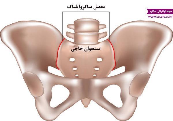 علت کمر درد در بارداری چیست و چگونه درمان می شود؟ علت کمر درد در بارداری چیست و چگونه درمان می شود؟