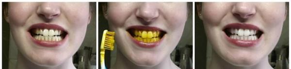 فواید و روش های سفید کردن دندان با زردچوبه