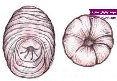 علت پرولاپس رکتوم (افتادگی مقعد) چیست؟