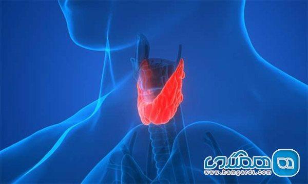 لزوم توجه به گره تیروئیدی پیش از بدخیم شدن