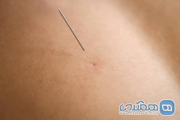 با درای نیدلینگ و کاربرد آن آشنا شوید