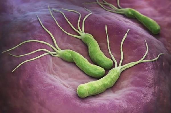 عفونت معده با هلیکوباکتر پیلوری (Helicobacter pylori) چطور تشخیص داده می گردد و درمان آن به چه صورت است؟