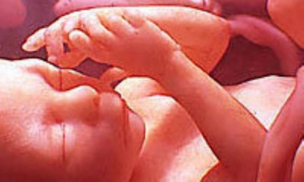 علایم مسمومیت حاملگی علایم مسمومیت حاملگی