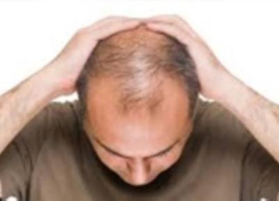 ویتامین های طبیعی ضروری برای جلوگیری از ریزش مو در زنان