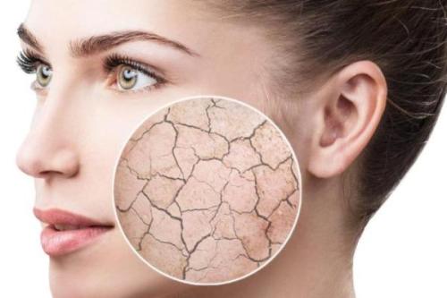 نکات مهمی که باید برای انتخاب یک مرطوب کننده پوست خشک بدانید